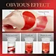 eye cream for wrinkles